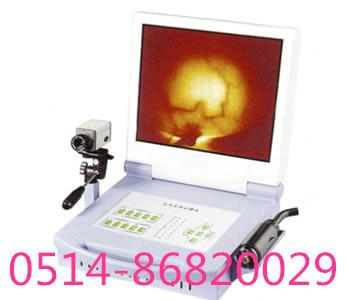 供应HK-999B红外乳腺诊断仪
